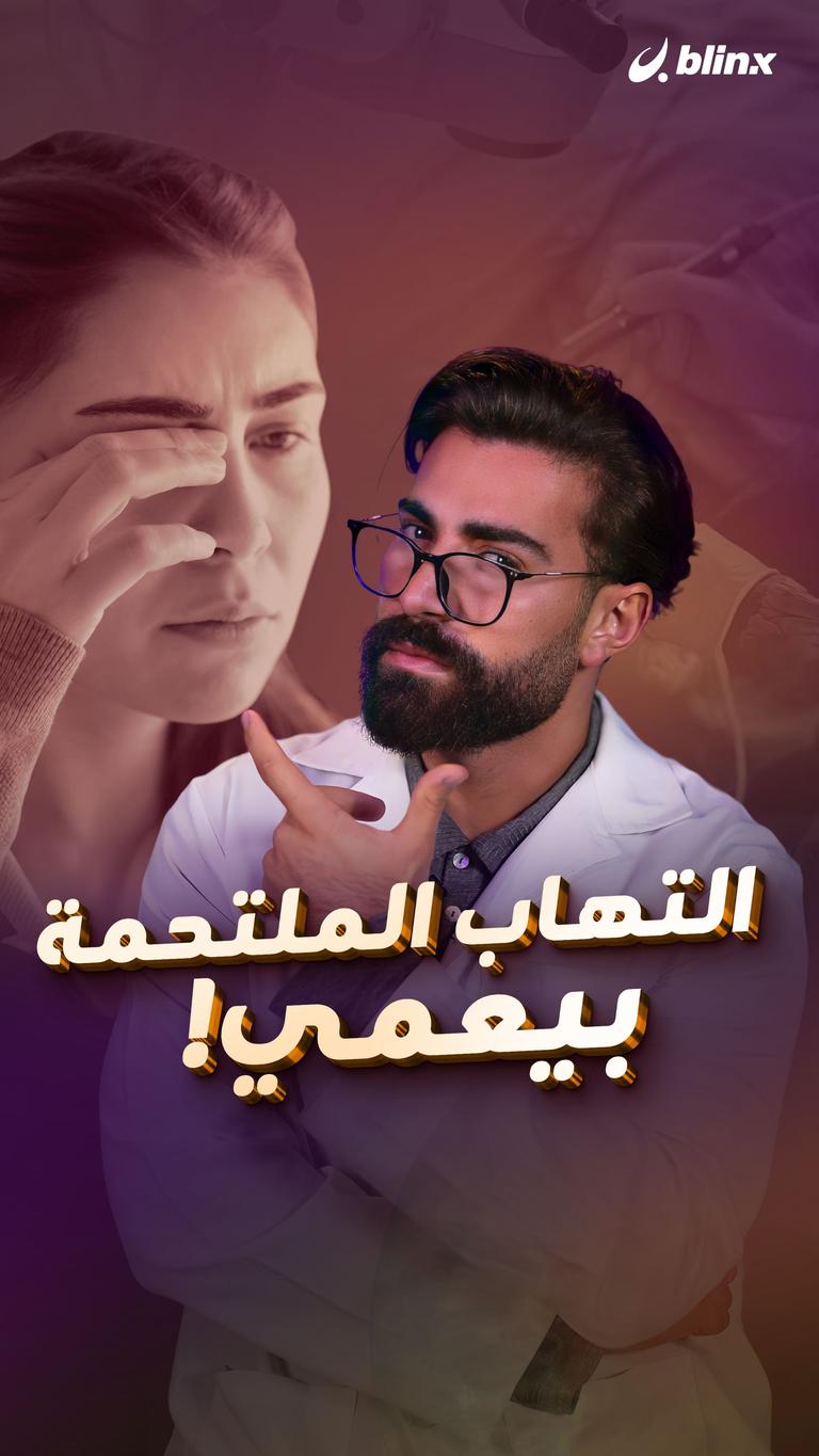 التهاب الملتحمة بيعمي!