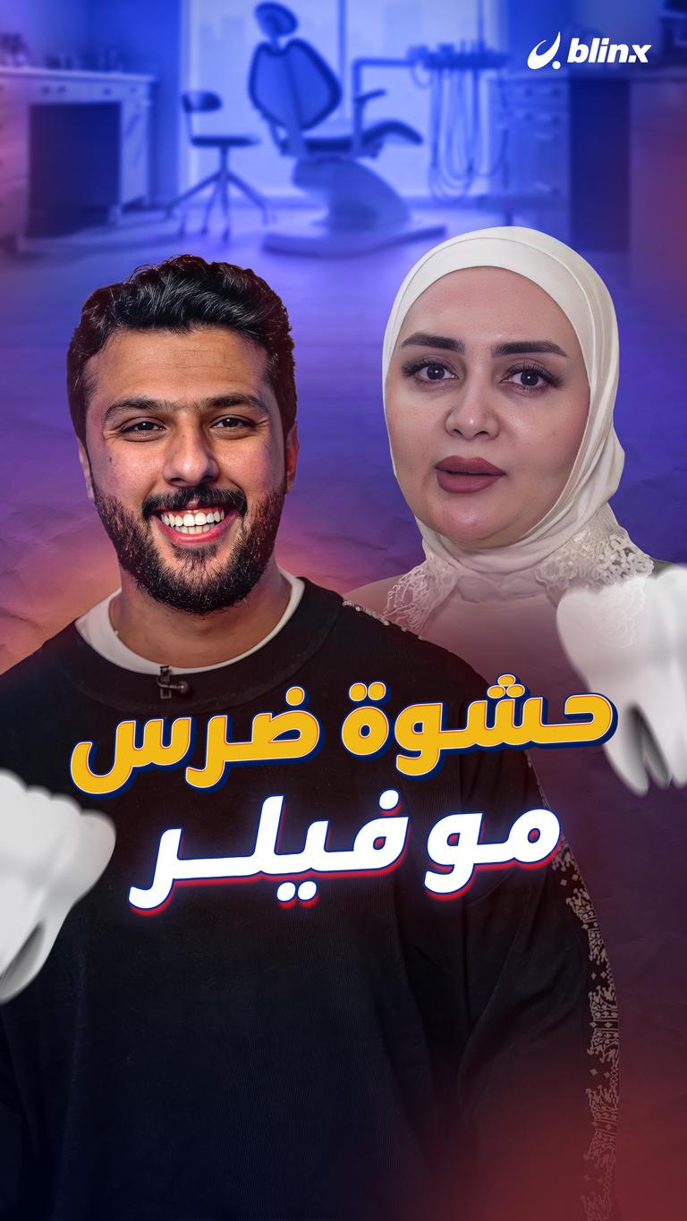 حشوة ضرس مو فيلر