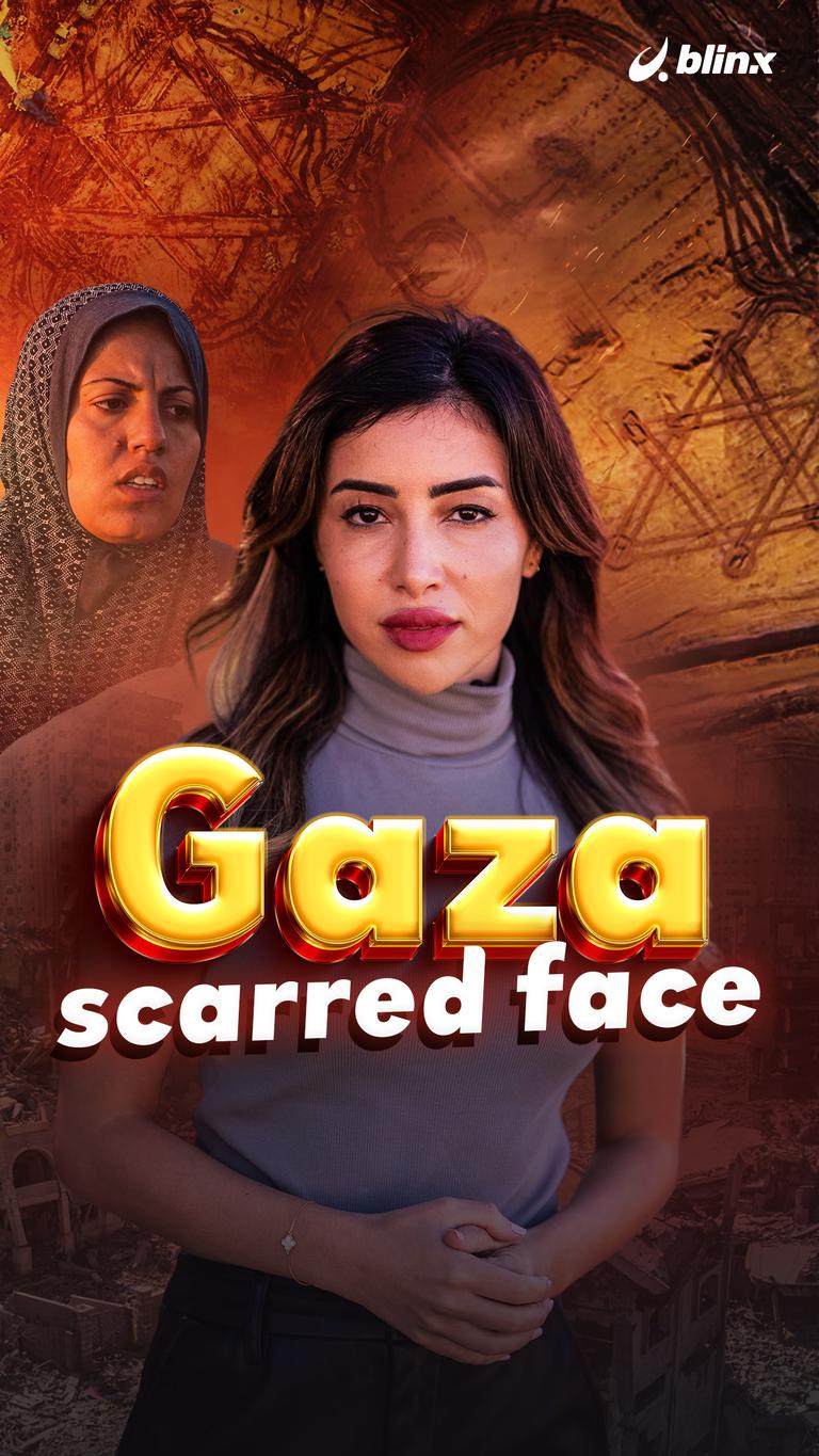 Gaza scarred face