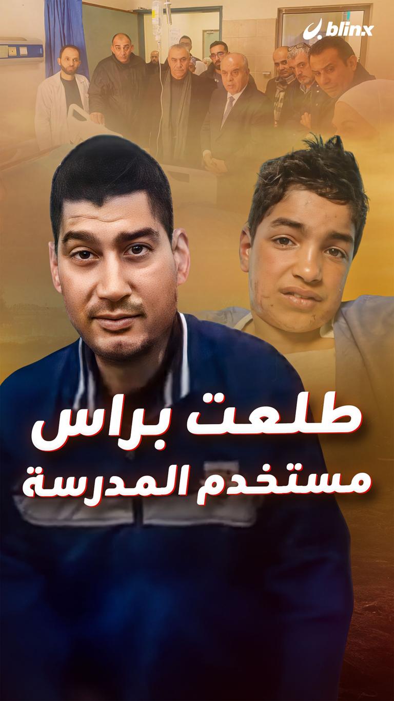 طلعت براس مستخدم المدرسة