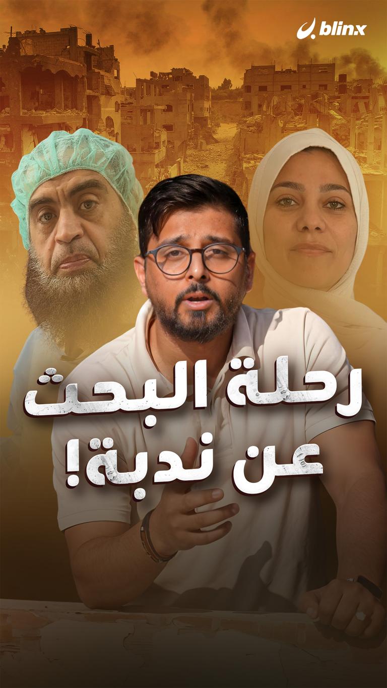 رحلة البحث عن ندبة!
