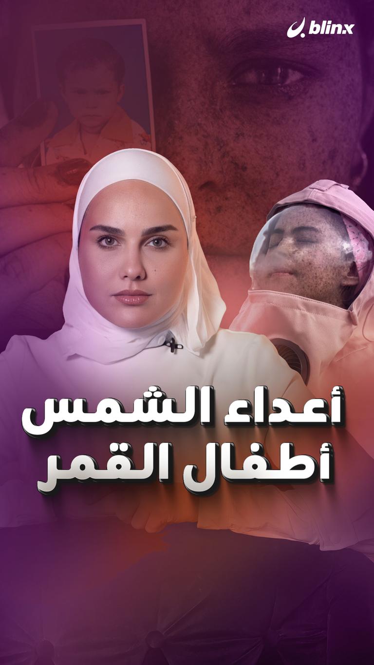 أعداء الشمس.. أطفال القمر