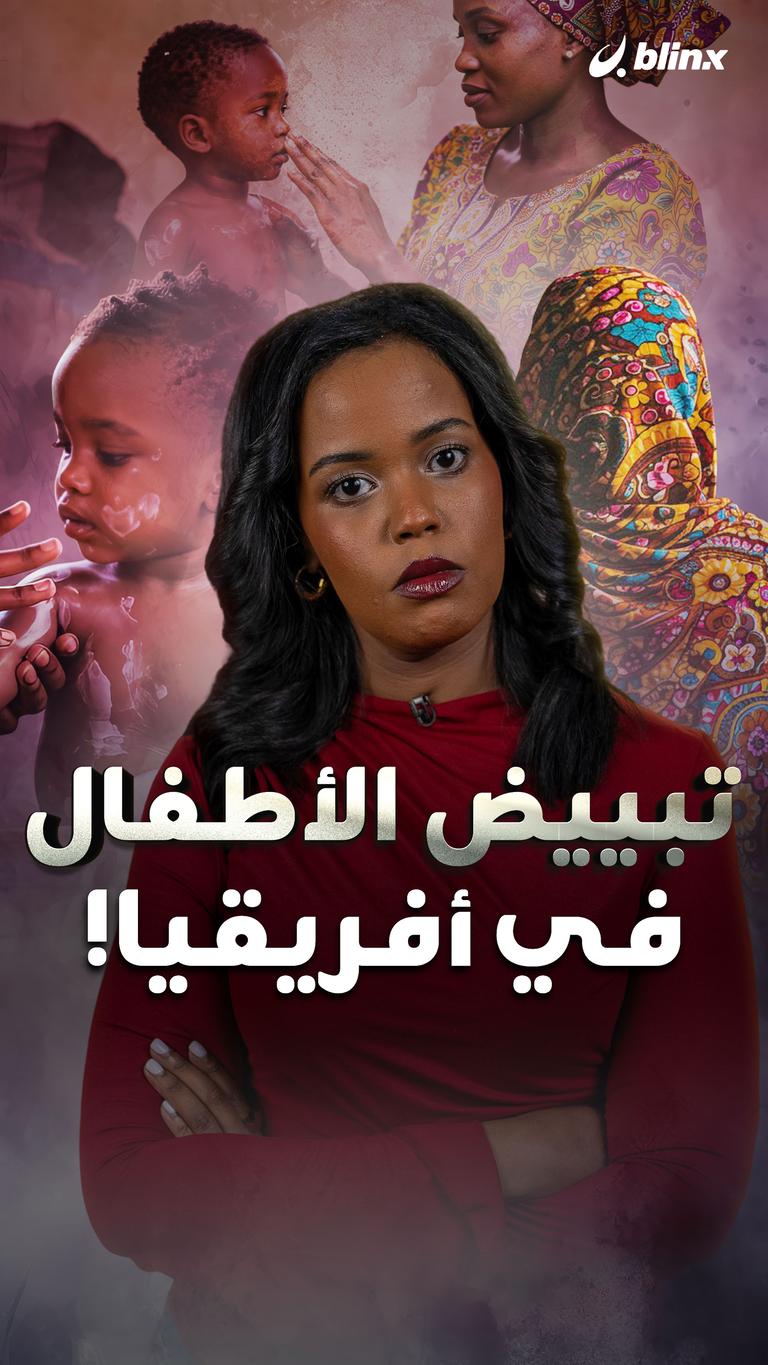 تبييض الأطفال  في أفريقيا!