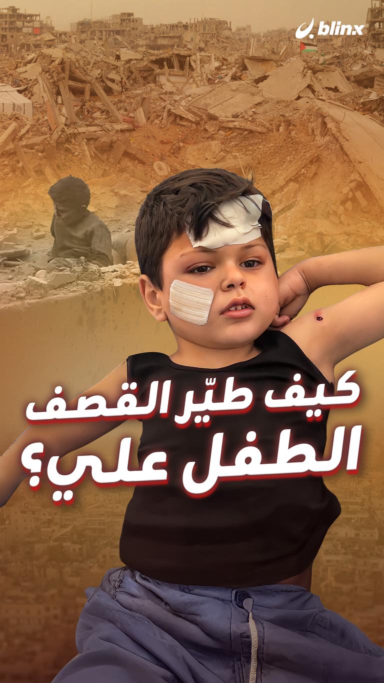 كيف طيّر القصف  الطفل علي؟