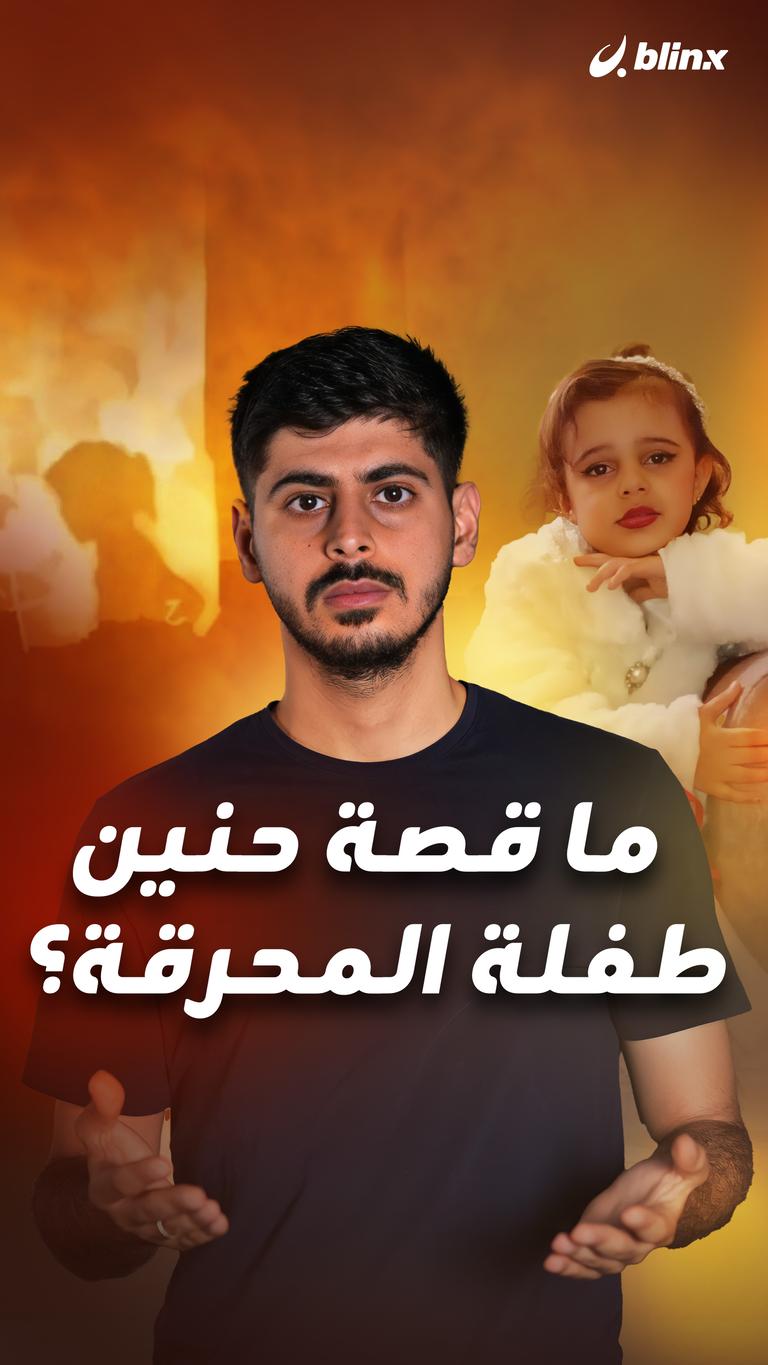 ما قصة حنين طفلة المحرقة؟