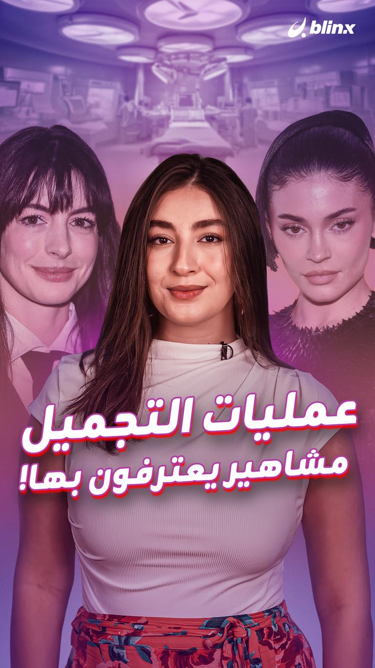 عمليات التجميل.. مشاهير يعترفون بها!