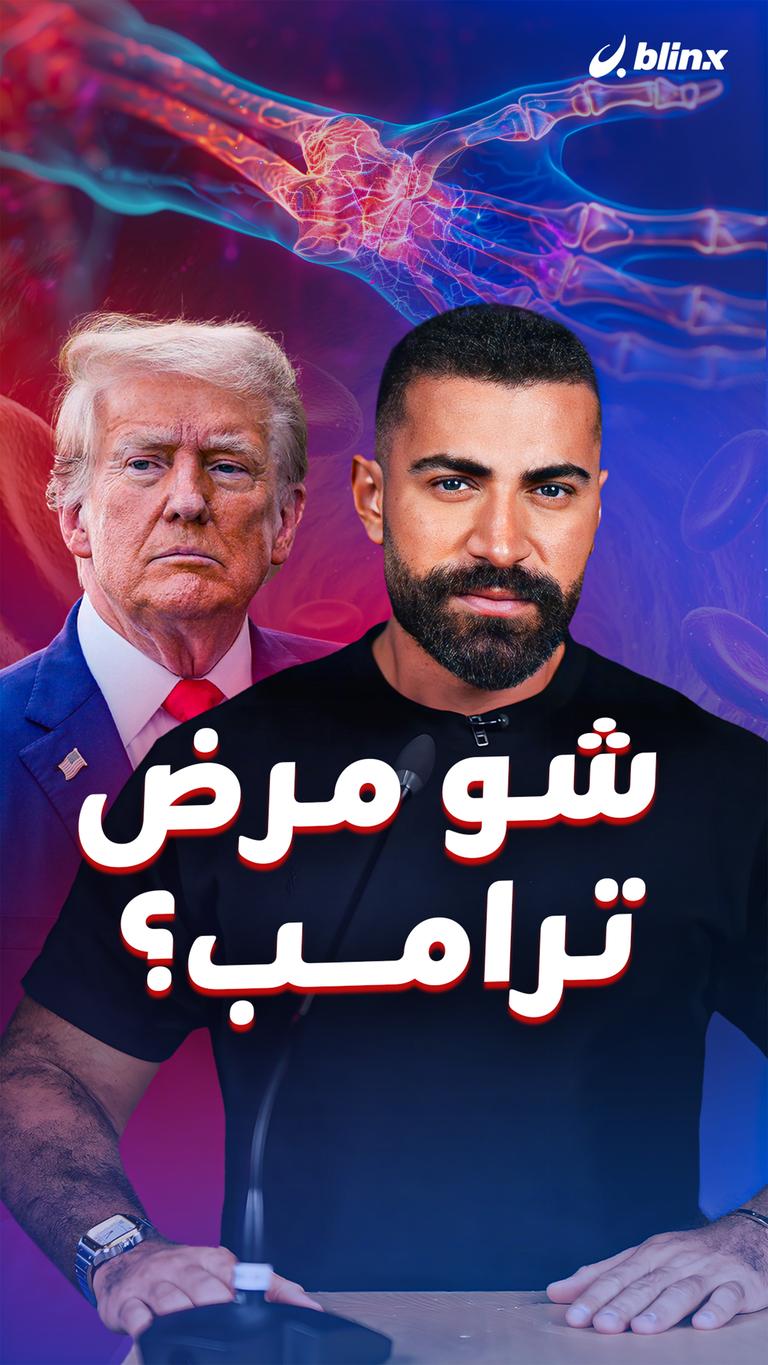 شو مرض ترامب؟