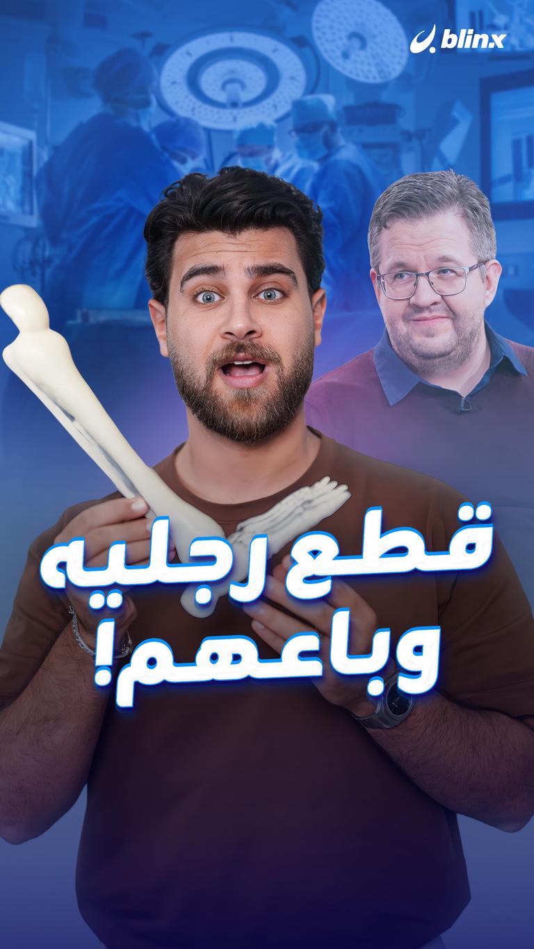 قطع رجليه وباعهم!