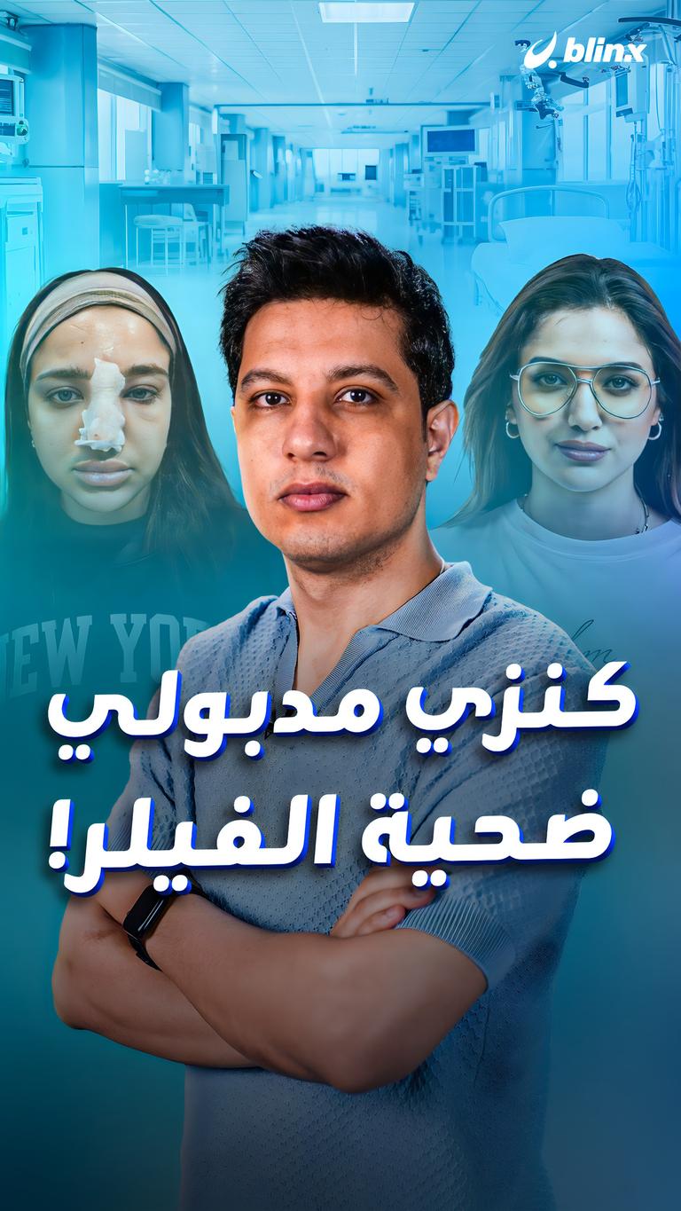 كنزي مدبولي ضحية الفيلر!