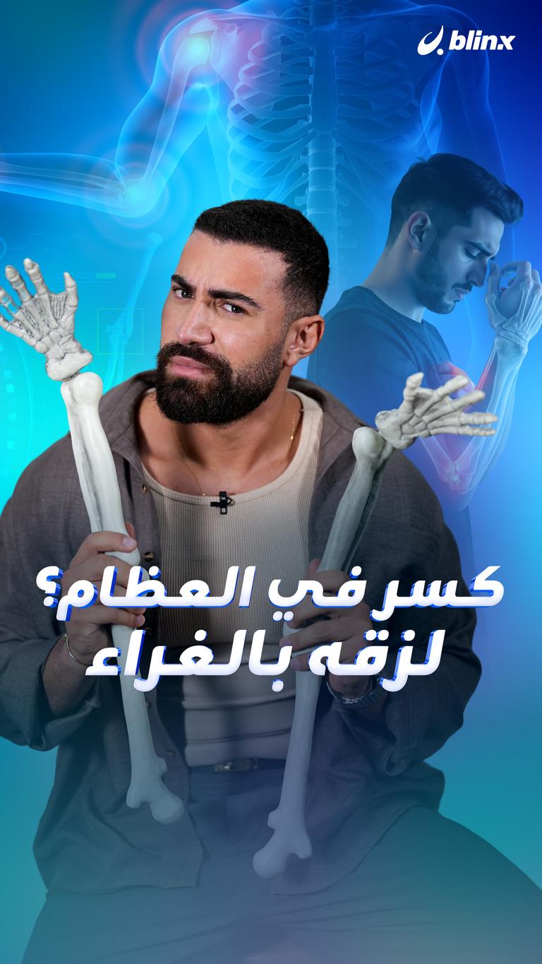 كسر في العظام؟ لزّقه بالغراء