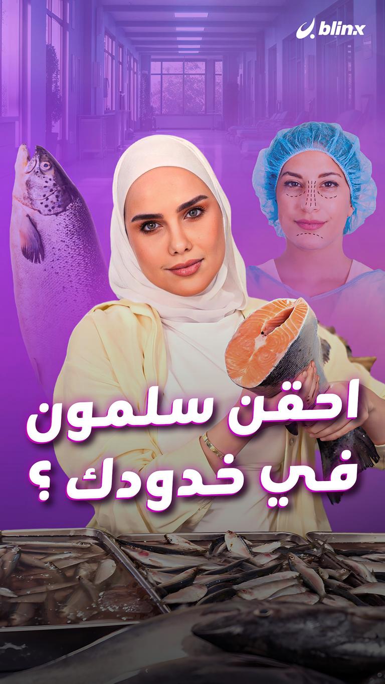 احقن سلمون في خدودك