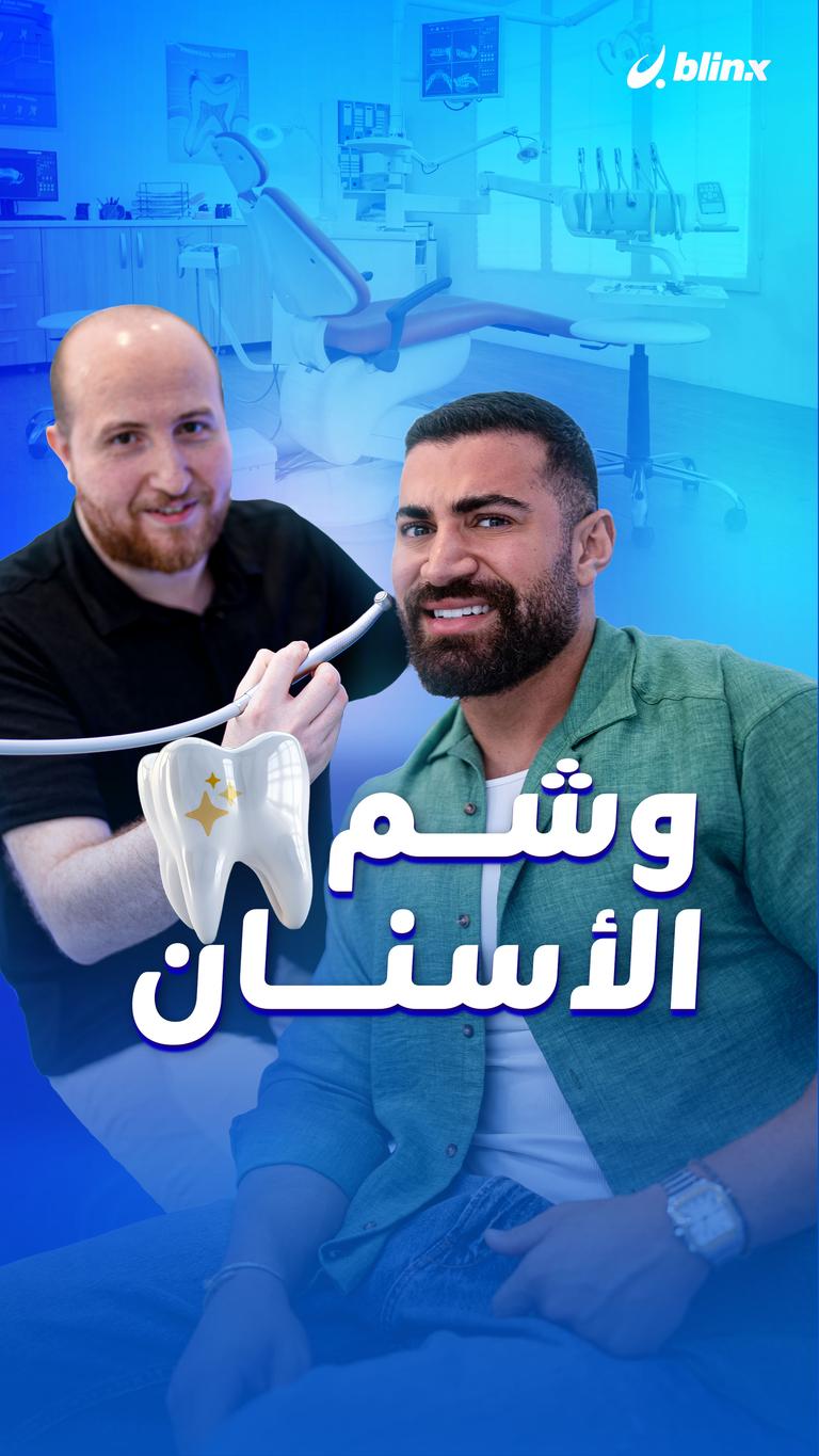 وشم الأسنان