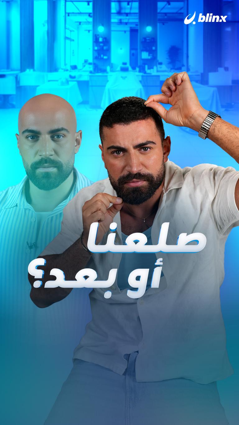 صلعنا أو بعد؟