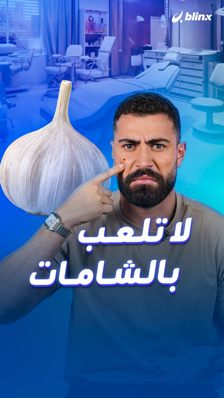 لا تلعب بالشامات