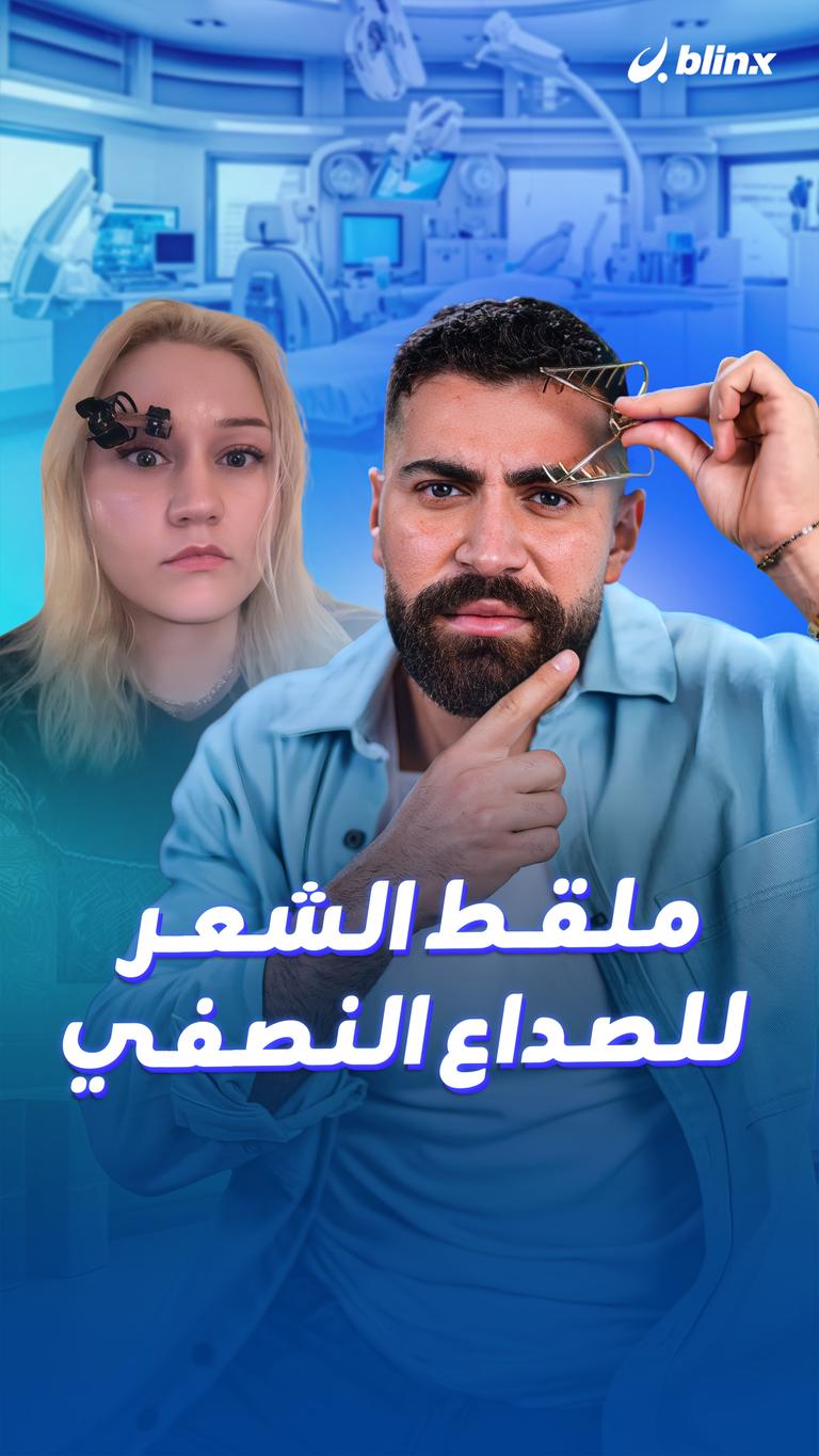 ملقط الشعر للصداع النصفي