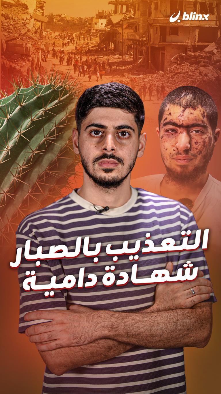 التعذيب بالصبار شهادة دامية