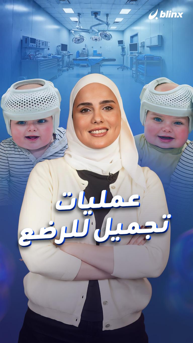عمليات تجميل للرضع