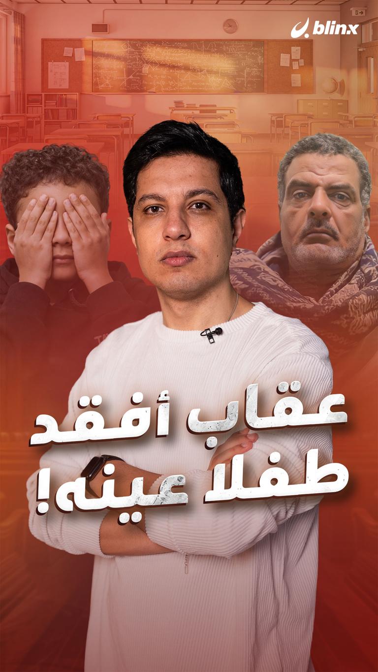 عقاب أفقد طفلا عينه!