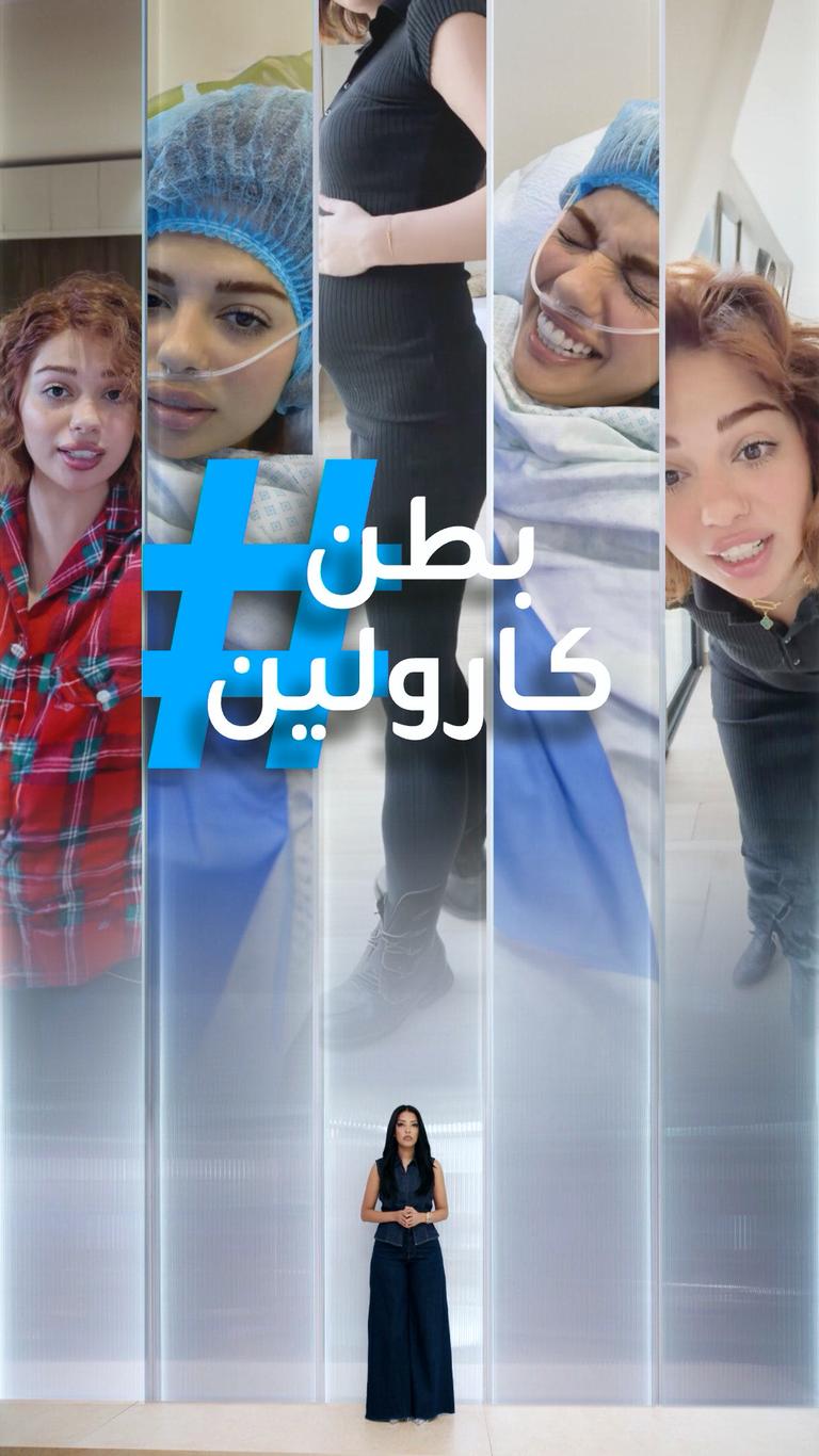 تريندات | بطن كارولين مارليني