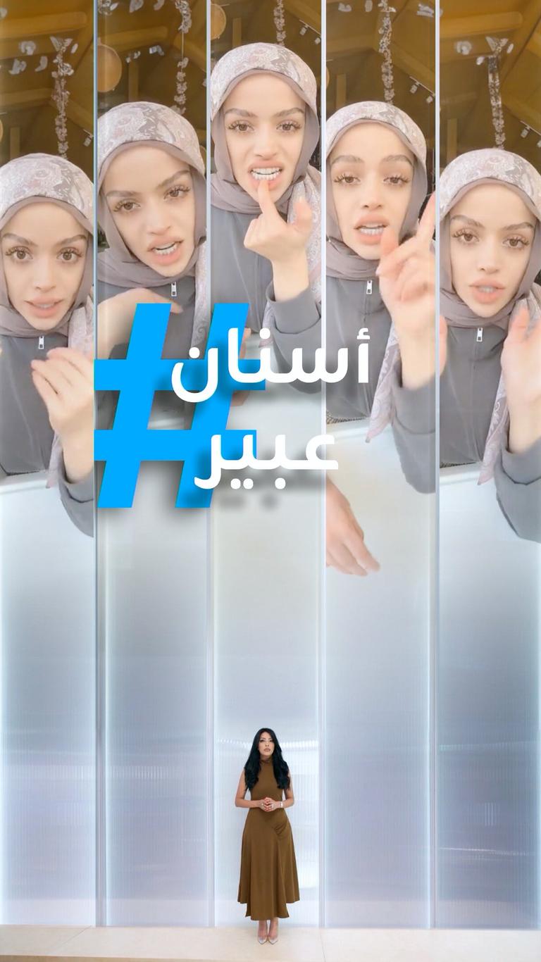 تريندات | فينير عبير الصغير