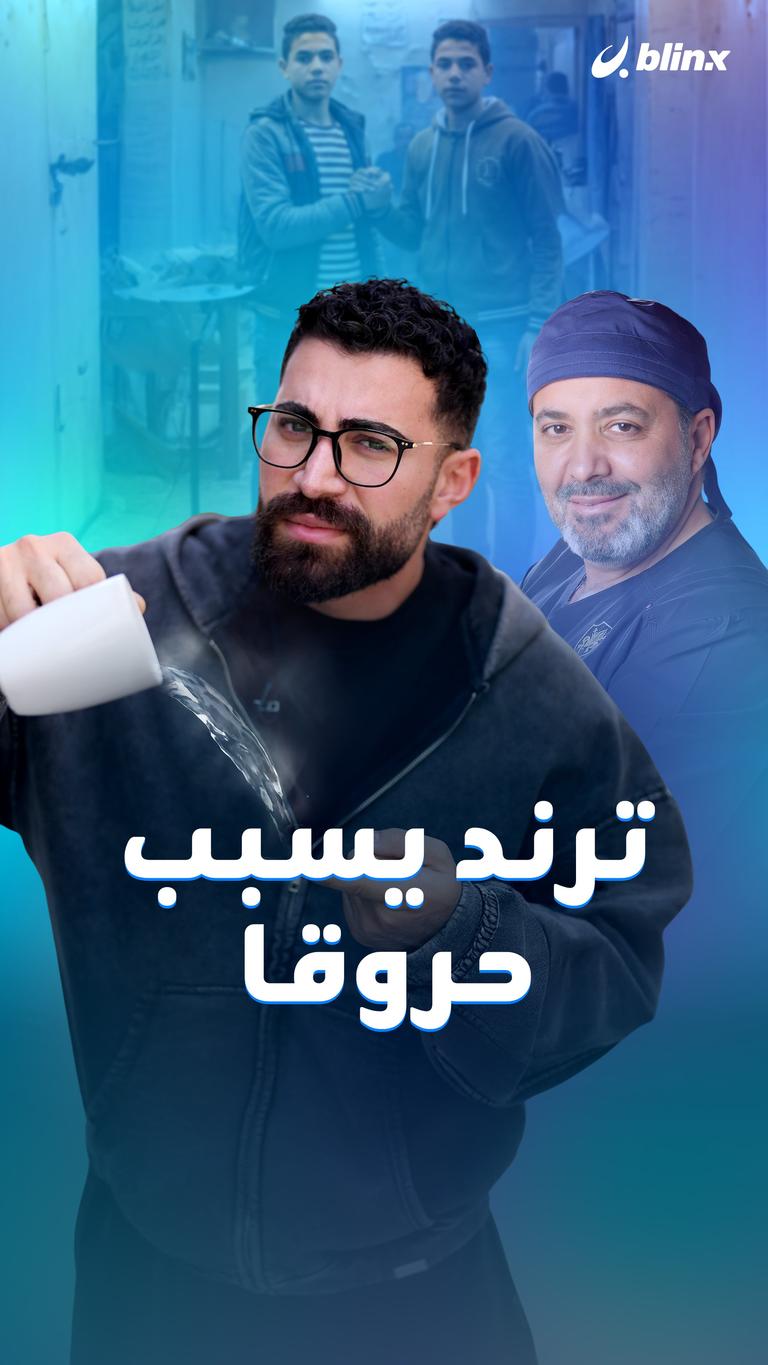 ترند يسبب حروقا