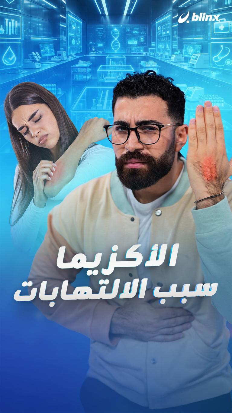 الأكزيما سبب الالتهابات