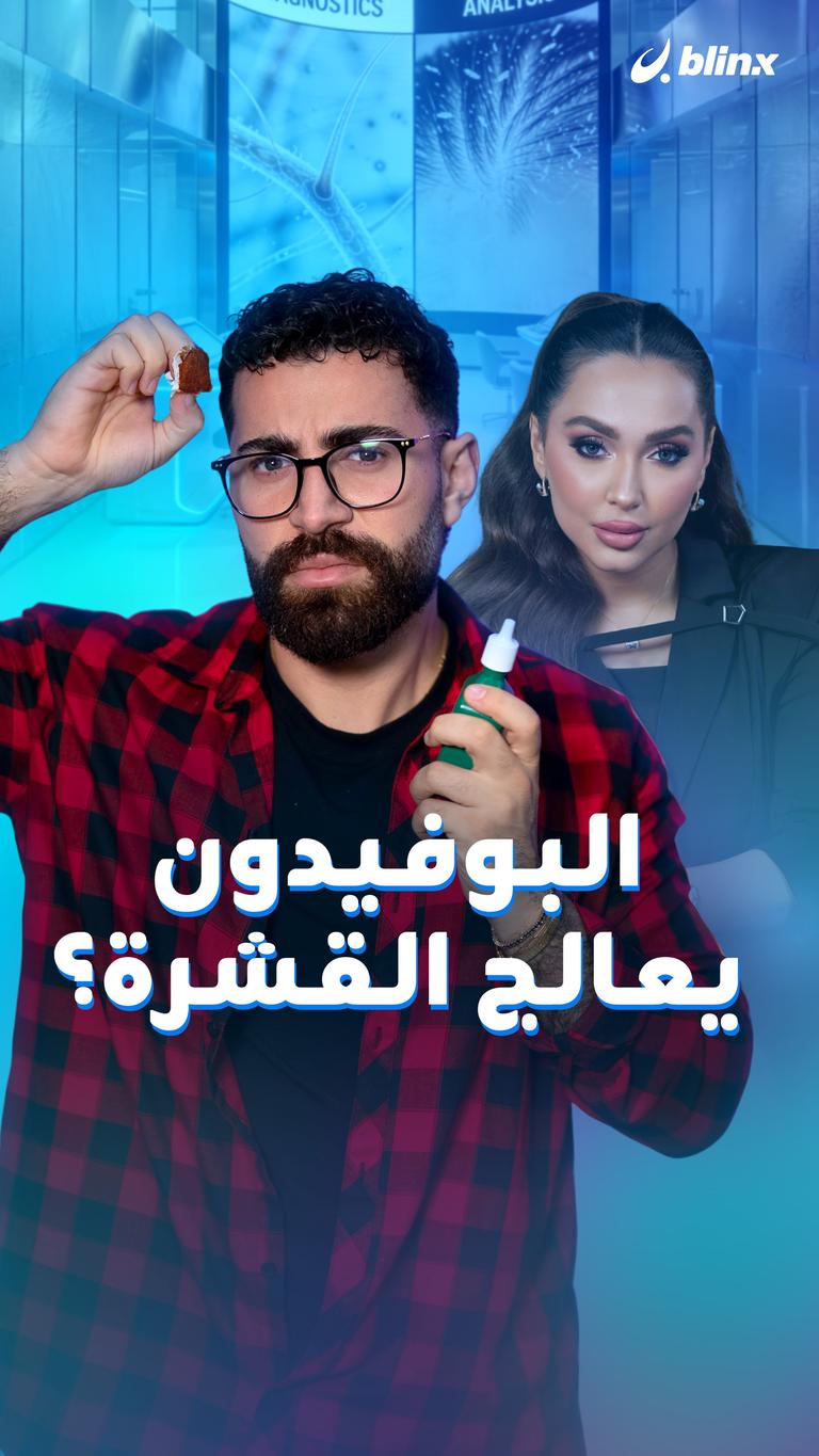 البوفيدون يعالج القشرة؟